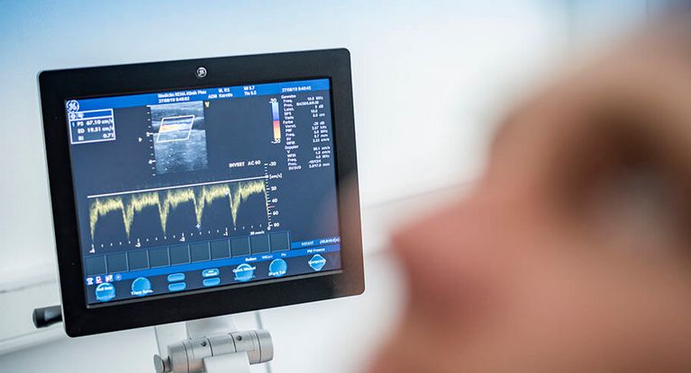 Vitalzeichen blinken auf dem Monitor