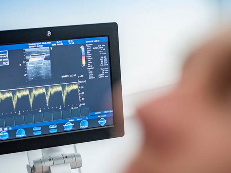 Vitalzeichen blinken auf dem Monitor
